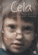 Cela. Odpowied� na zesp� Downa